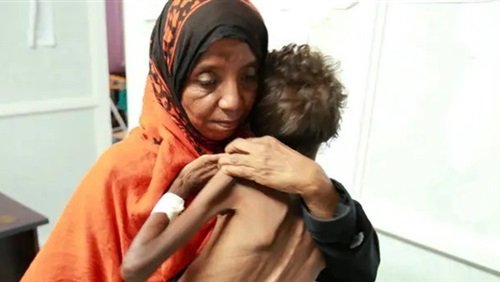 ميليشيا الملالي باليمن