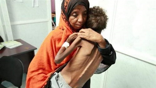 بسبب الحوثيين ..يموت