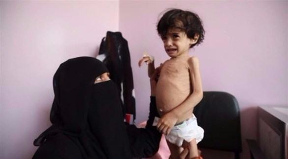 الوضع الانساني: