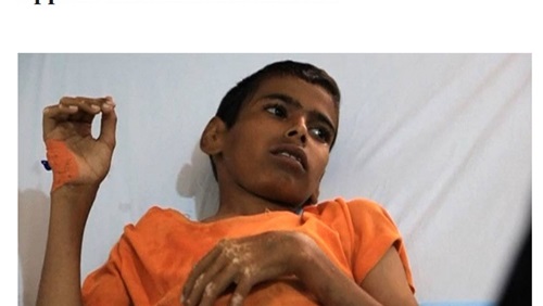 حادث هامبورج والأوضاع