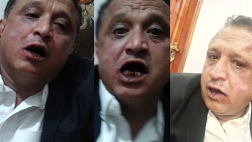 لمطالبته بتسليم الرواتب
