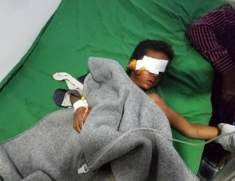 إصابة أطفال بقصف